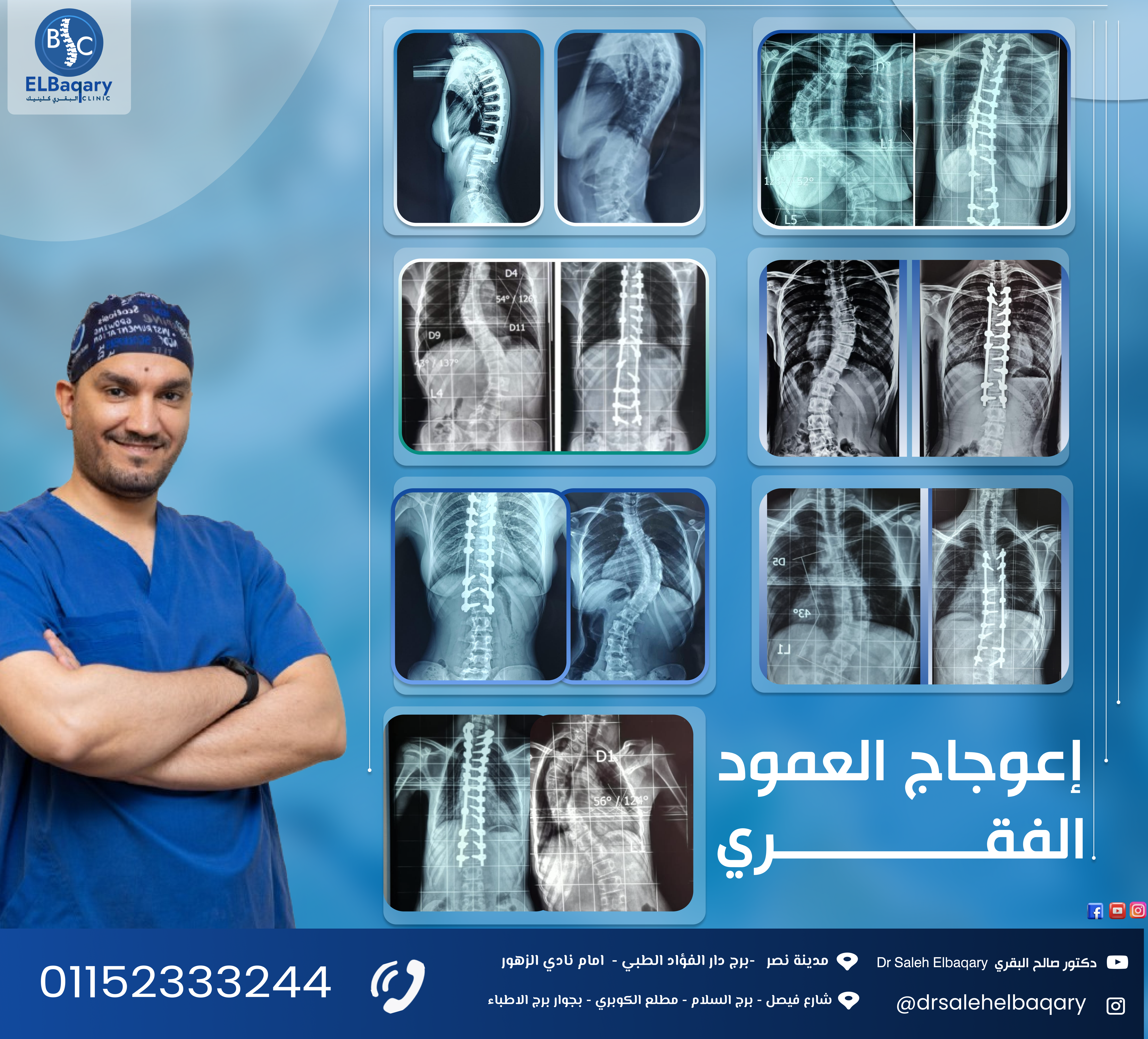 نسب إستعدال تتخطي ال 99 % و أكثر 
